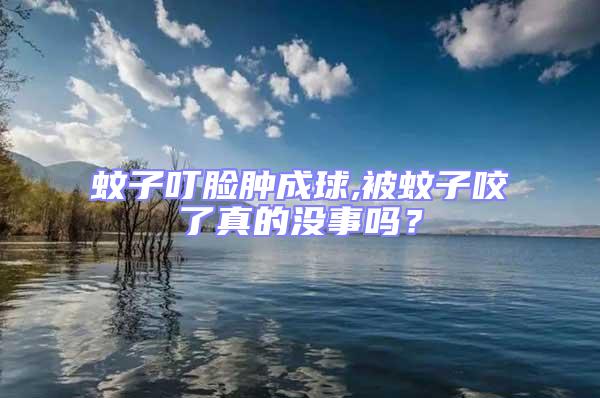 蚊子叮臉腫成球,被蚊子咬了真的沒(méi)事嗎？