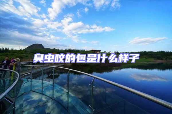 臭蟲咬的包是什么樣子